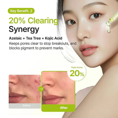 Azelaic Acid 10 Kojic Tea Tree Serum
